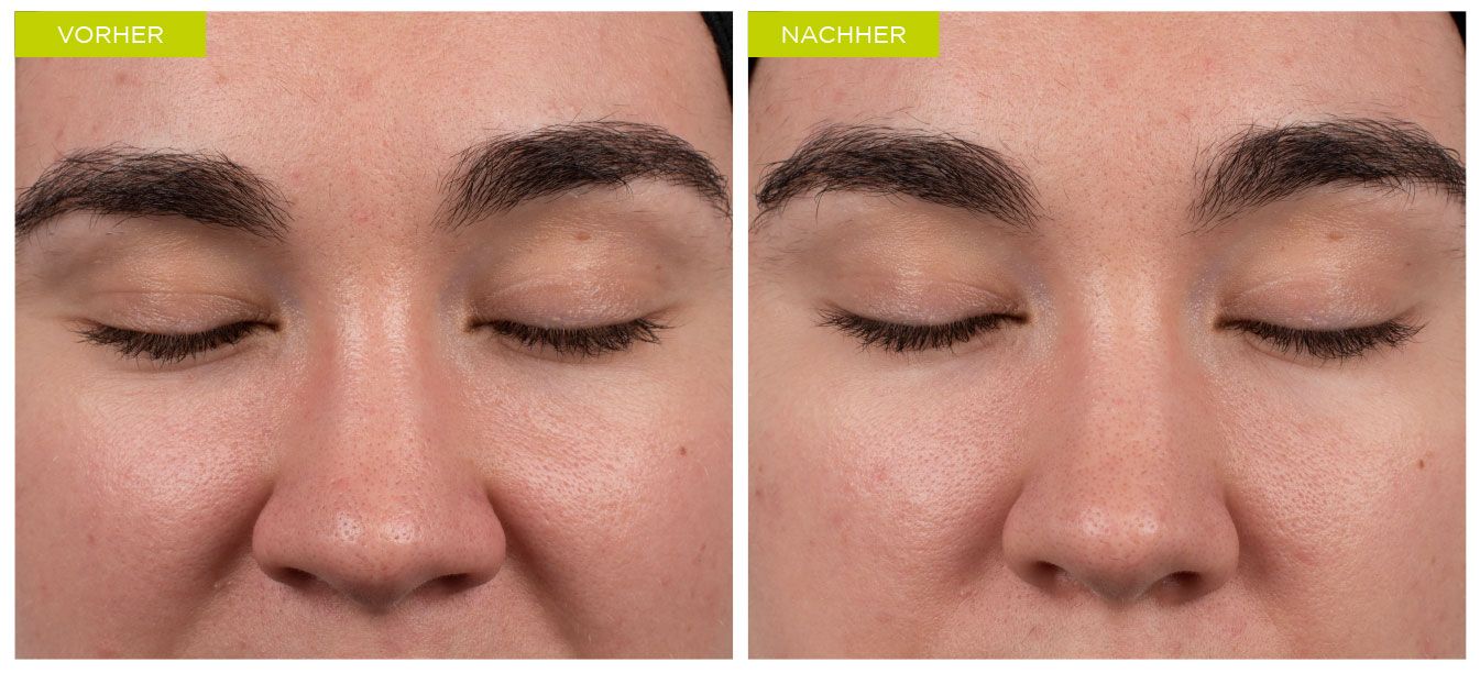 BIOME+ Dew Bright Serum – Vorher-Nachher-Vergleich